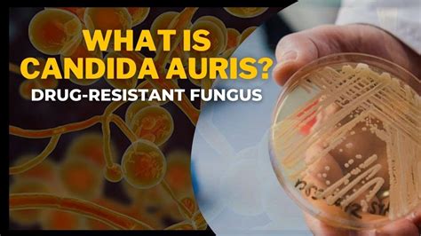 What are the symptoms of Candida auris, the drug-resistant fungus spreading in 28 states?